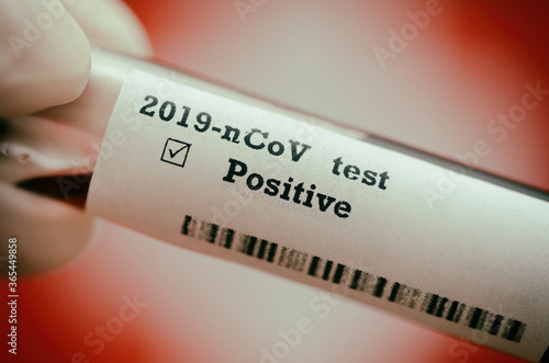 Stock photo of holding tube with Blood Test(novel Coronavirus 2019 disease,COVID-19,nCoV) and Flag of Switzerland. Switzerland virus outbreak.