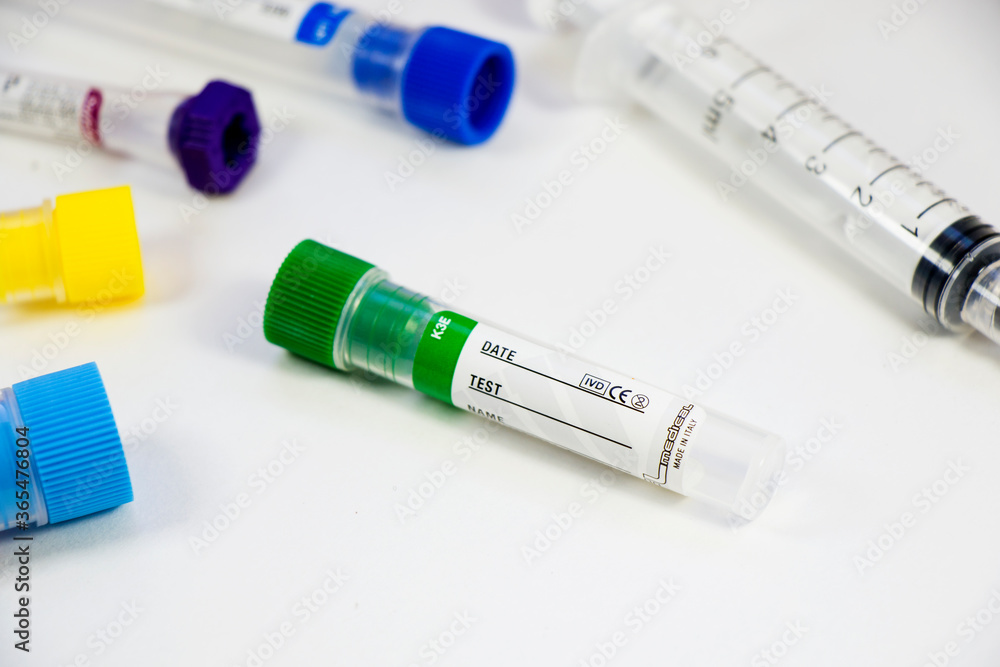 Virus test samples. Diagnosis and laboratory. Studio shoot, white background. Virus test samples. Diagnosis and laboratory. Studio shoot, white background.