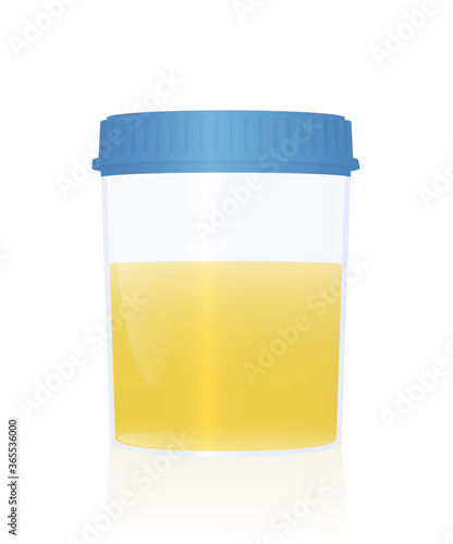 Urine sample in a specimen cup with blue cap for urological analysis and medical examination. Isolated vector illustration on white background.
