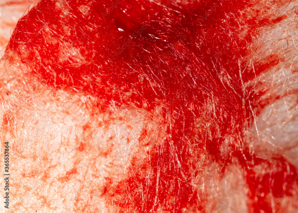 Red human blood on white cotton wool.
