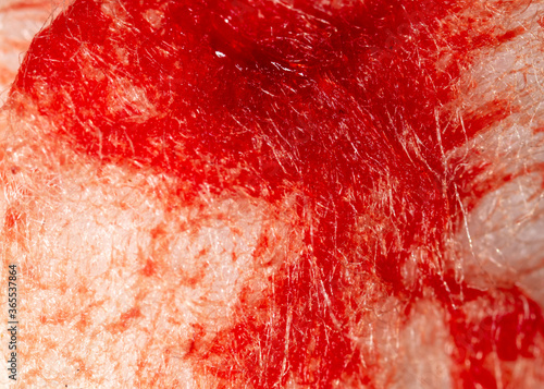 Red human blood on white cotton wool.