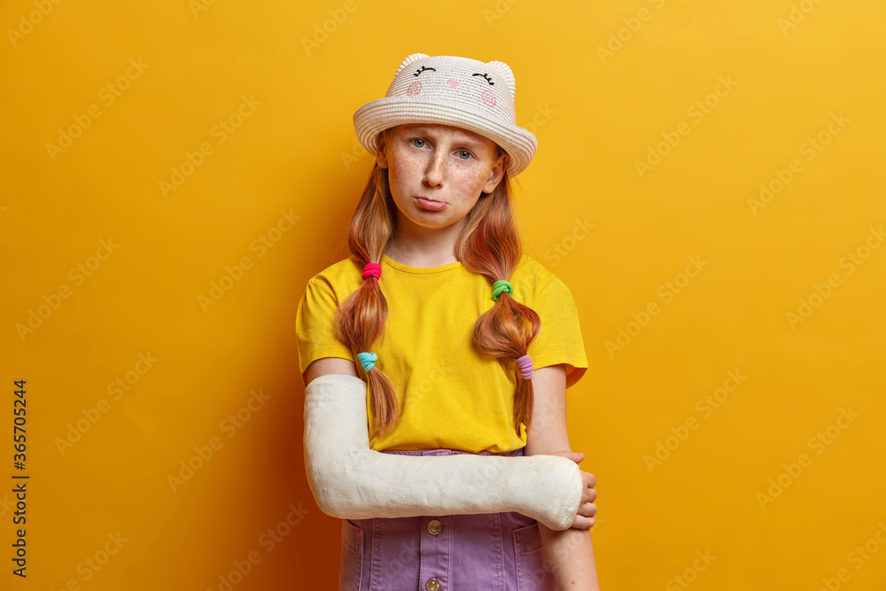 Upset sullen ginger girl broke arm during rolleblading, suffers from pain and fracture, wears cast, has bad mood, dressed in summer clothes, visited doctor, got into accident, has plastered hand Upset sullen ginger girl broke arm during rolleblading, suffers from pain and fracture, wears cast, has bad mood, dressed in summer clothes, visited doctor, got into accident, has plastered hand