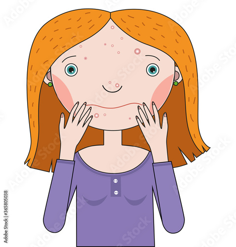 Beautiful girl with a face on which pimples