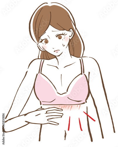 ブラジャー　夏　痒み　ブツブツ