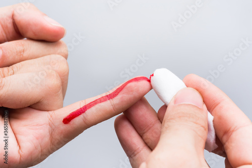 Use a cotton wool to wipe the blood at the wound on fingertips that are bleeding.