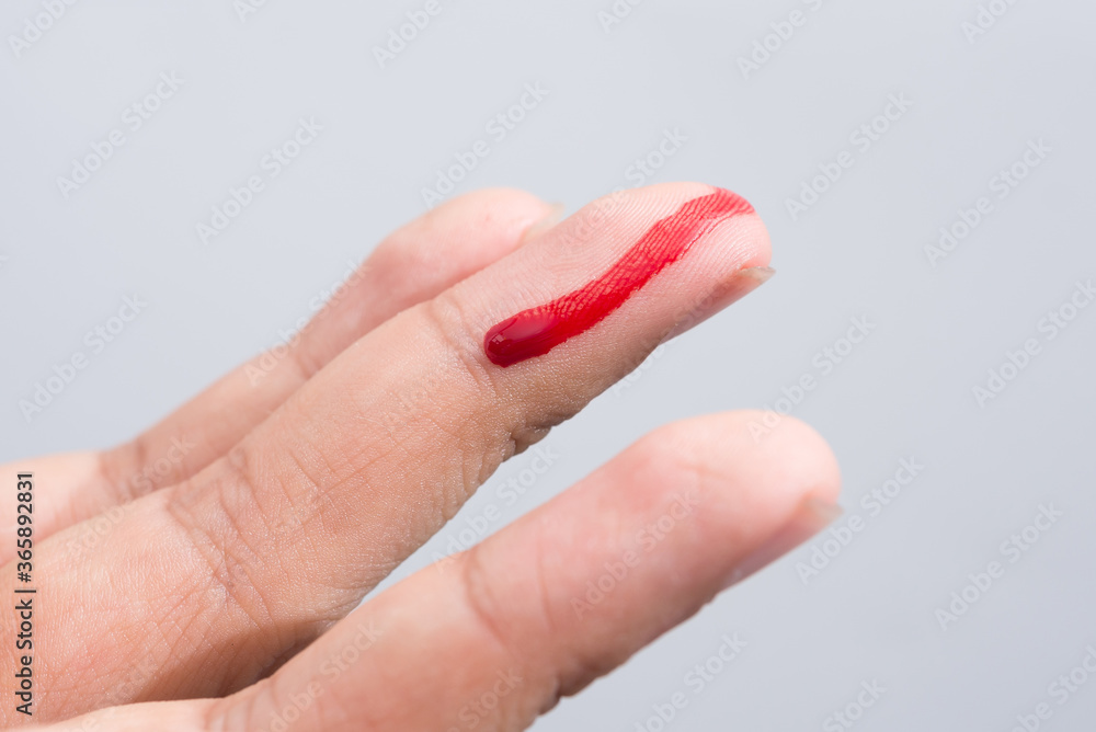 Bleeding blood from the cut finger wound. Injured finger with bleeding