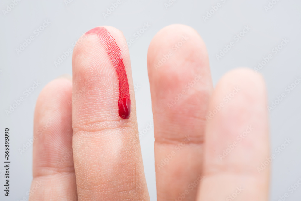 Bleeding blood from the cut finger wound. Injured finger with bleeding