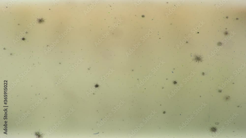 growth of colonies of pathogenic bacteria in laboratory analysis of food quality control. Time lapse of growing microbial and fungal growth of colonies of pathogenic bacteria in laboratory analysis of food quality control. Time lapse of growing microbial and fungal
