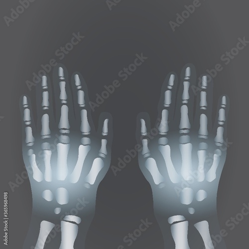 x-ray of human hands