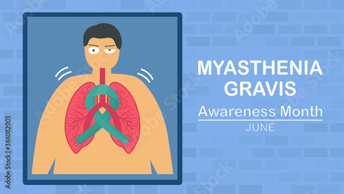 Myasthenia gravis is neuromuscular disease that leads to make muscle weakness. These include eyes, face, and swallowing. Pulmonology vector illustration about restrictive lung disease.