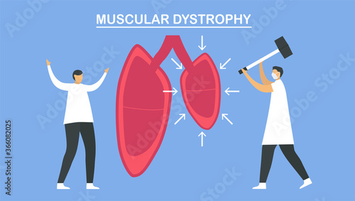 Muscular dystrophy is diseases that cause weakness and loss of muscle mass. Pulmonology vector illustration about restrictive lung disease.