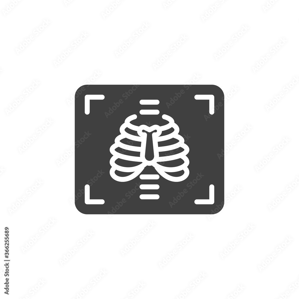 Chest xray vector icon. filled flat sign for mobile concept and web