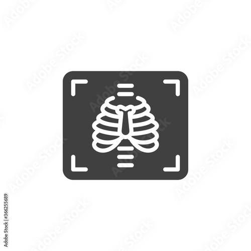 Chest x-ray vector icon. filled flat sign for mobile concept and web design. Medical X ray glyph icon. Symbol, logo illustration. Vector graphics