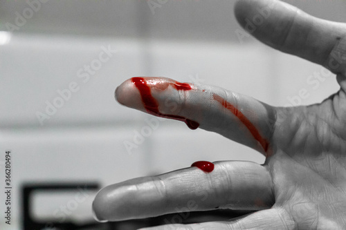 Female cut finger in kitchen - accident while cutting - blood on finger