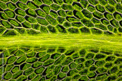 Microscopic view of moss leaf (Plagiomnium affine). Darkfield illumination.