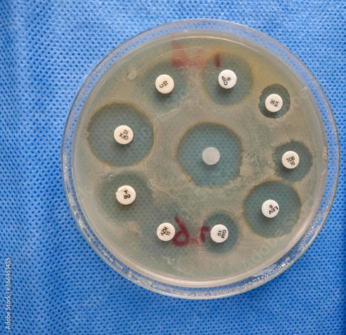 antibiotic susceptibility test on agar photo