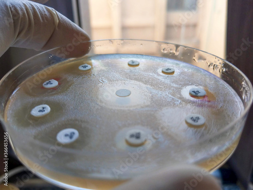 antibiotic susceptibility test on agar photo