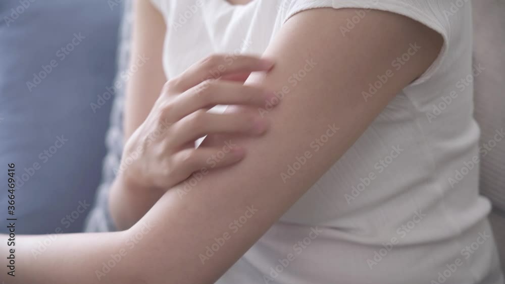 腕を掻いている若い女性 腕を掻いている若い女性