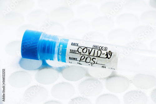 Corona virus and Covid-19 positive test samples. Diagnosis and laboratory. Studio shoot, white background.
