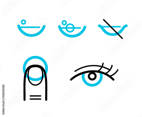 Contact lens