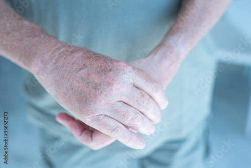 mani di persona anziana con alzaimer photo