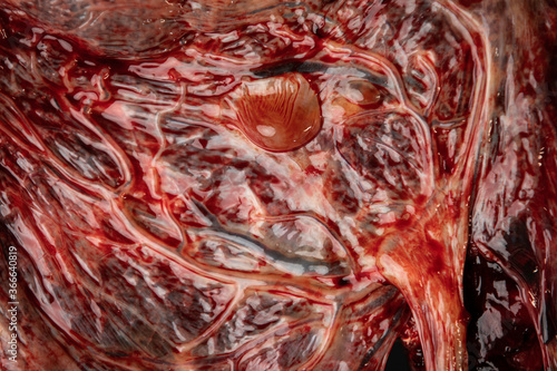 Placenta Organ