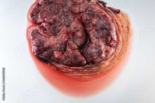 Placenta Organ