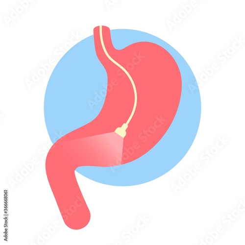 Gastroscopy icon. endoscope with light in stomach. Medical exam.  inspection of stomach. digestive problems. Hose with camera. Cartoon flat illustration.