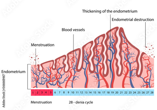 changes in uterine endometrial destruction photo