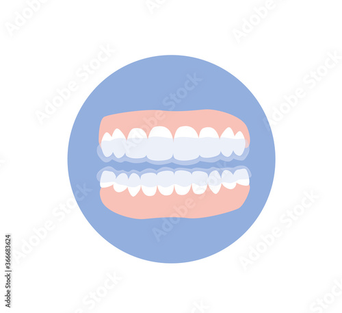 Teeth with retainers after braces. Jaws isolated. Flat vector illustration.