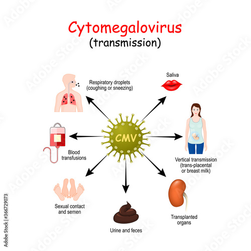 transmission of cytomegalovirus infection photo