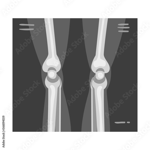X-ray Film of Leg Joints Vector Illustrated Image for Educational Purpose