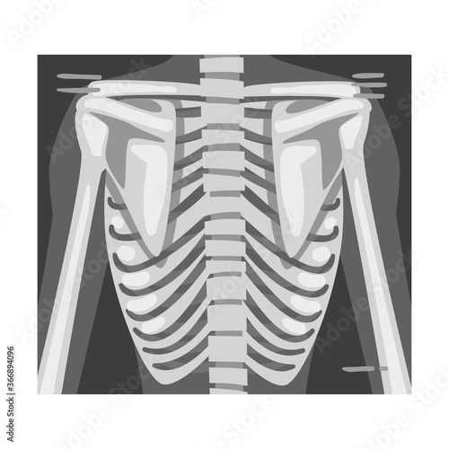 X-ray Film of Spine Vector Illustrated Image for Educational Purpose