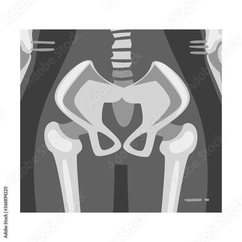 X-ray Film of Coxofemoral Joint Back View Vector Illustrated Image for Educational Purpose
