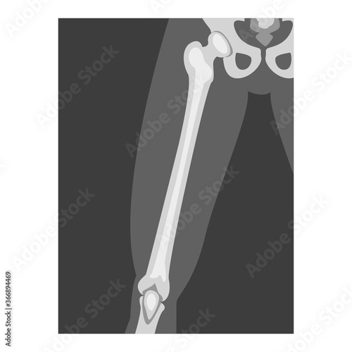 Roentgenograph of Upper Leg Front View Vector Image