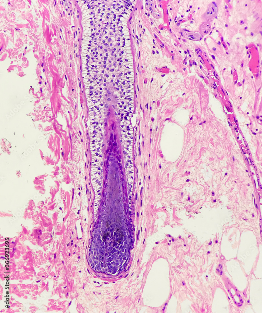 Hair Follicle Under Microscope