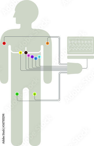 ECG wiring diagram showing 6+2+2 colour-coded sensors connected to a trunk / break-out box and a laptop computer.