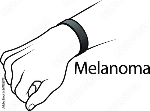 A hand with a cause bracelet. Black, Melanoma.