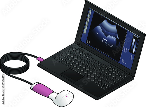 A portable ultrasound scanner wand connected to a laptop computer.