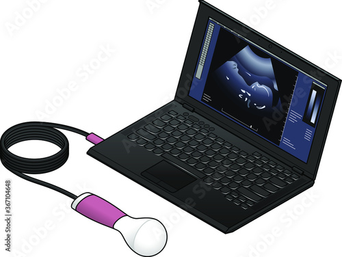 A portable ultrasound scanner wand connected to a laptop computer.