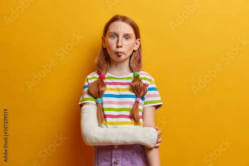 Cute funny small girl with popped eyes, imitates fish and keeps lips folded, has playful mood, isnt afraid of showing emotions, foolishes around, has broken arm, wears casual summer clothes.