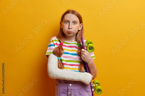 Children, hobby, pastime concept. Redhead girl blows cheeks and stares at camera, has freckled skin poses with skateboard wears cast on broken arm isolated on yellow studio wall. Unlucky skateboarding