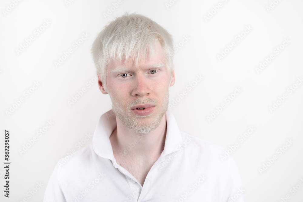 portrait of an albino man in  studio dressed t-shirt isolated on a white background. abnormal deviations. unusual appearance