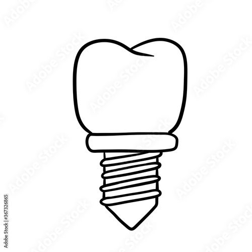 Tooth pin. Dentist element. Dental care and implant. Medical white part with the thread for the mouth. Doctor job. Black and white illustration. Operation for health