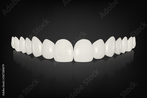 Vector 3d Realistic Render White Denture Set Closeup Isolated. Dentistry and Orthodontics Design. Human Teeth for Medical and Toothpaste Concept. Healthy Oral Hygiene, Jaw Prosthesis, Veneers