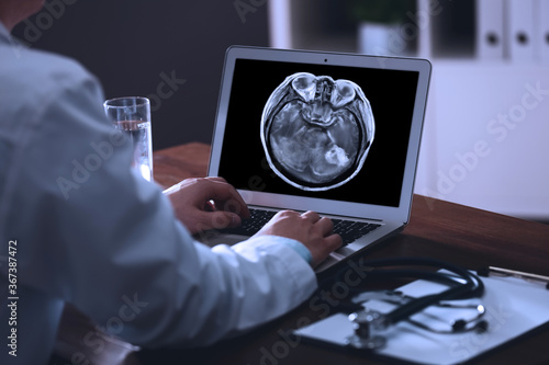 Canvas Print Doctor examining x-ray of patient with brain cancer on laptop in clinic, closeup