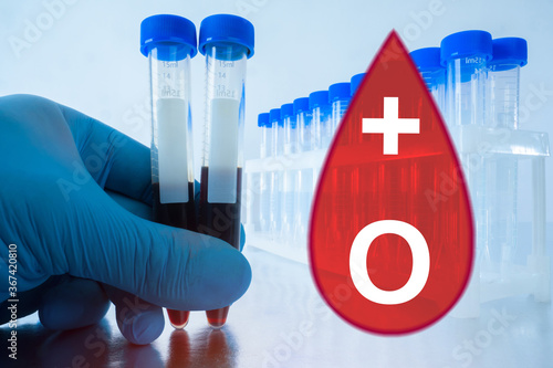 Blood test. Determination o...