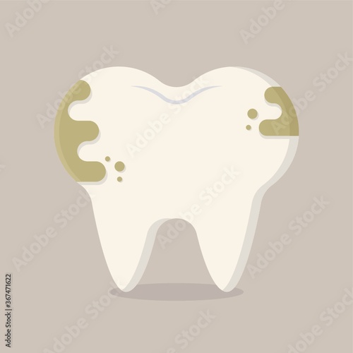 tooth cavity