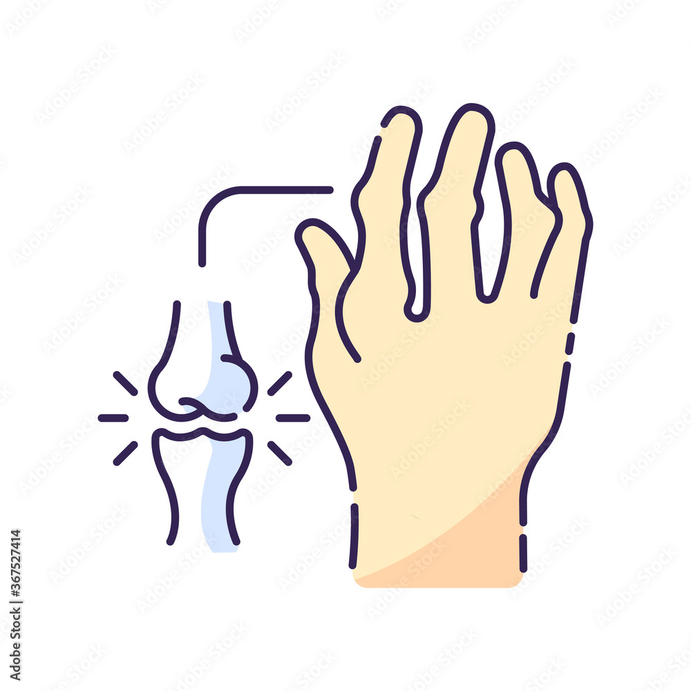 Obraz premium Rheumatoid arthritis RGB color icon. Pathological disease. Damaged bones in hand. Impact of chronic disorder for human arm. Injury in joint. Human disability. Isolated vector illustration