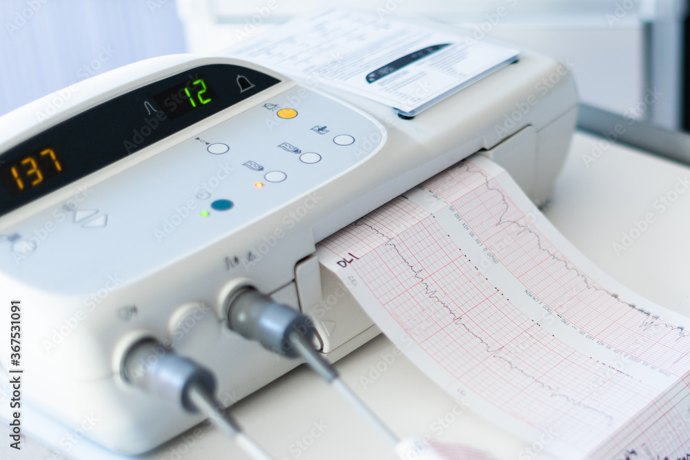 Cardiogram of the baby before birth Cardiogram of the baby before birth